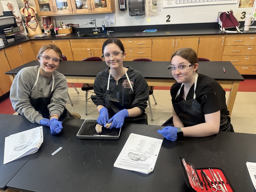 dissection of the brain