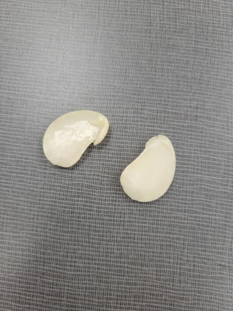 varner's science- bean disecting