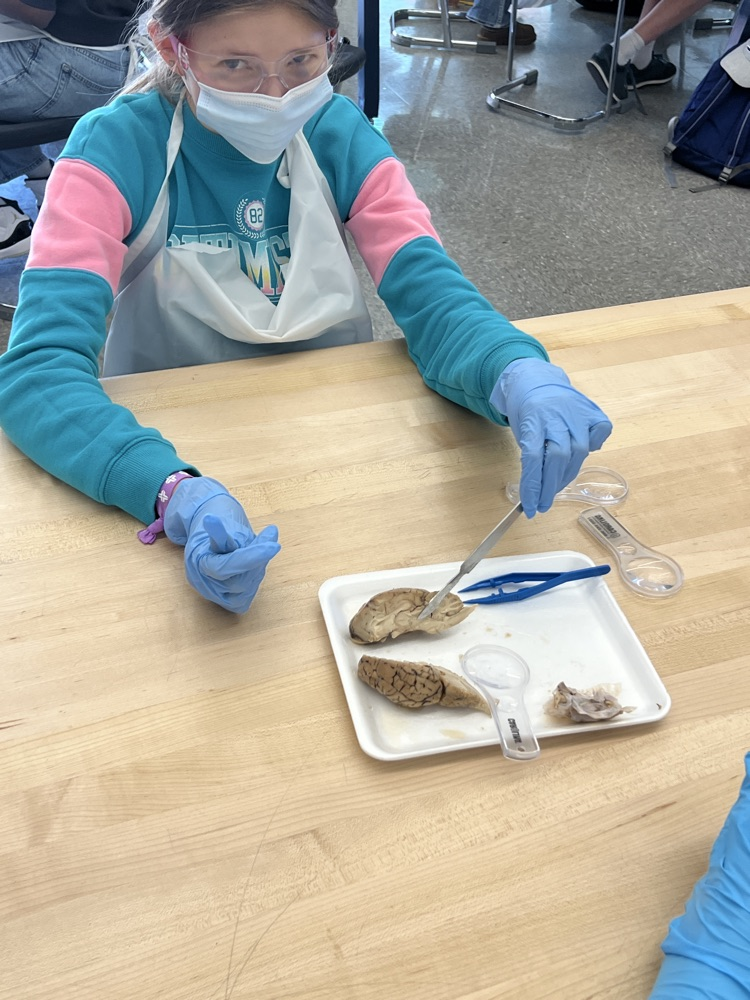 kids dissecting a brain 