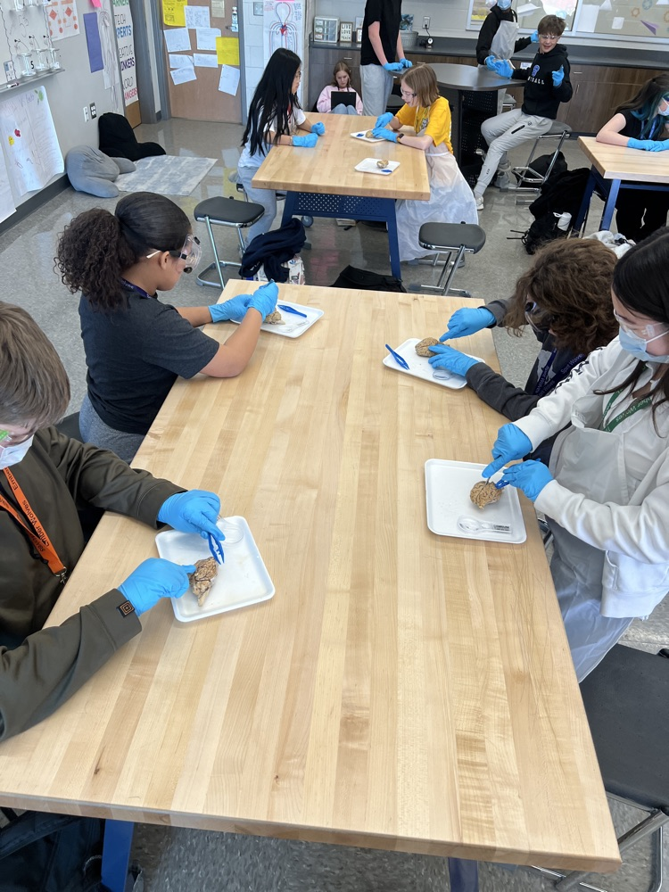 kids dissecting a brain 