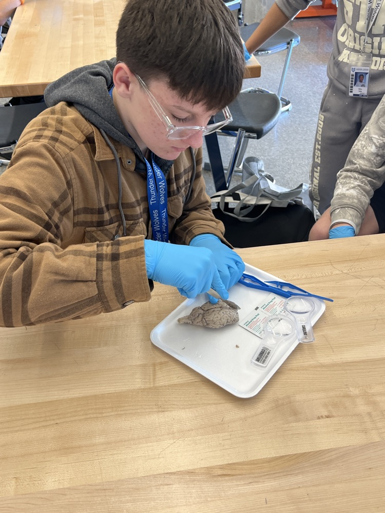 kids dissecting a brain 