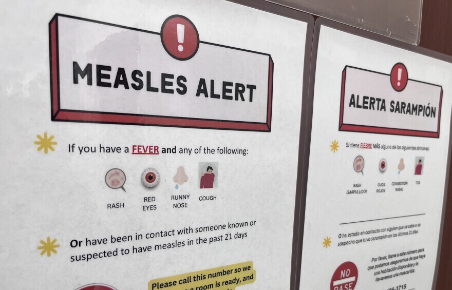 Measles