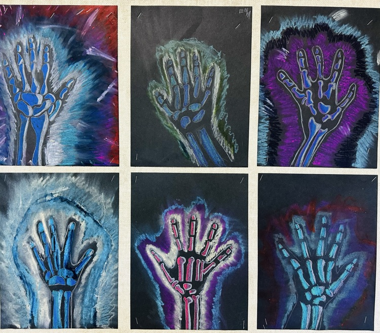 xray hands