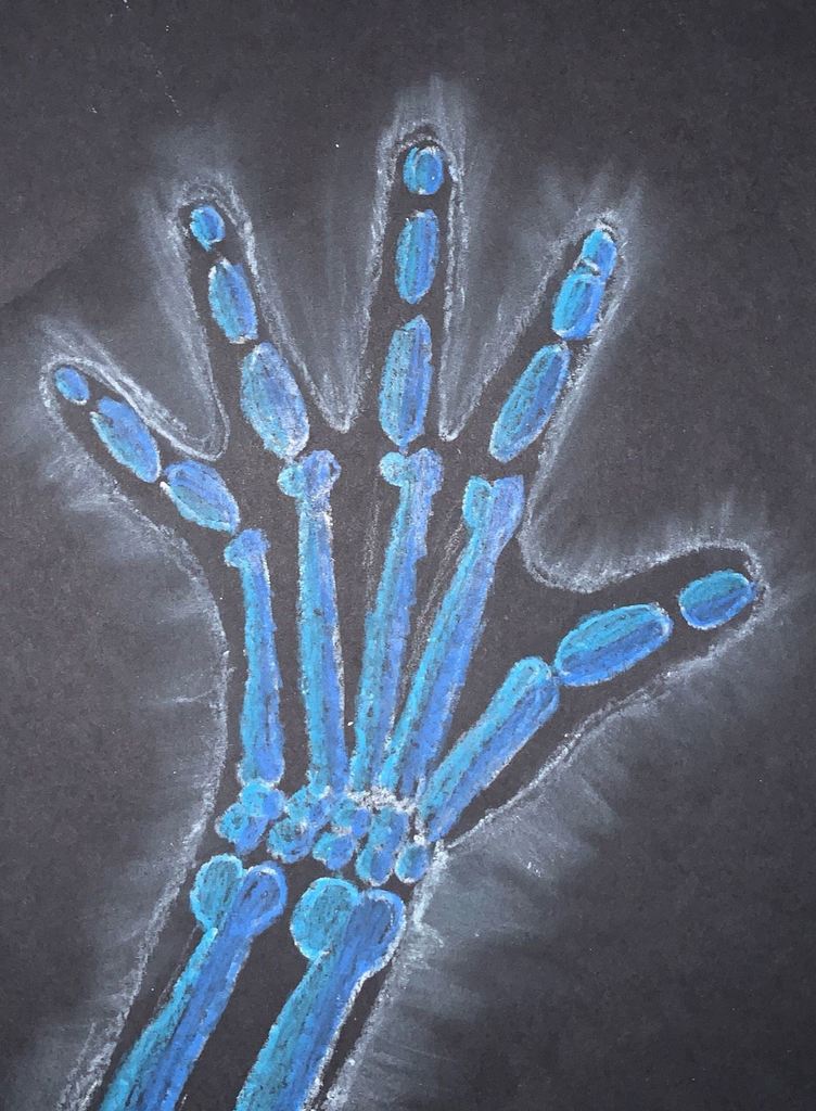 x-ray hand art