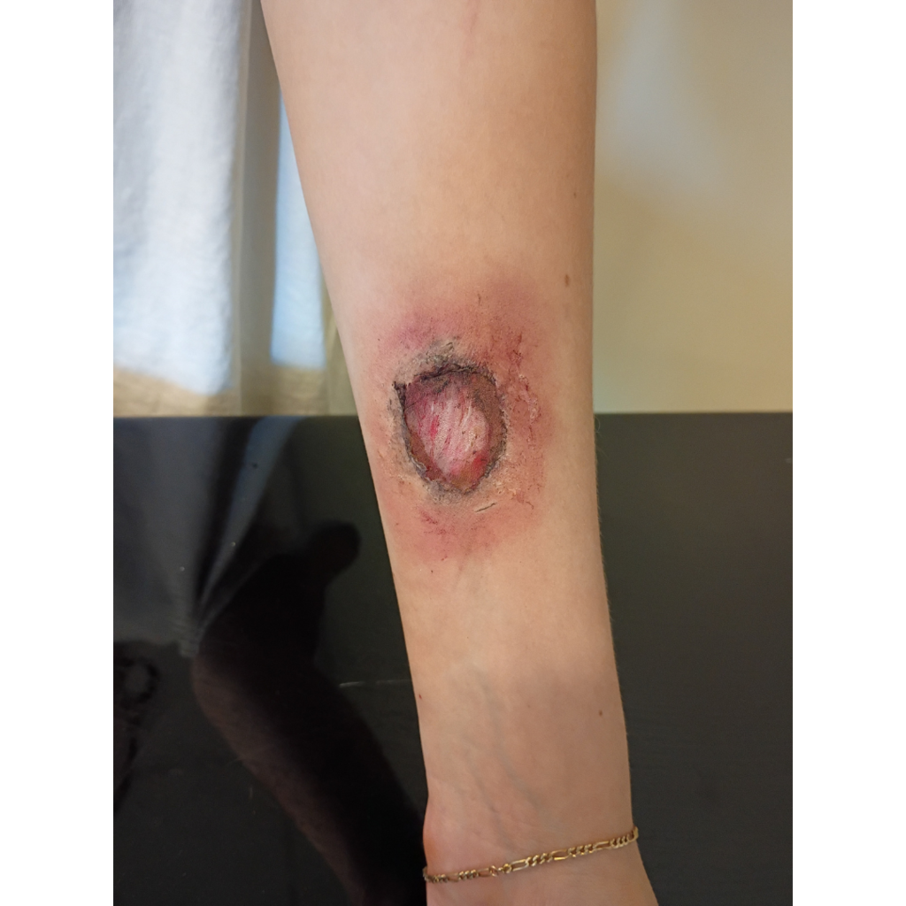 fake laceration on a student's arm