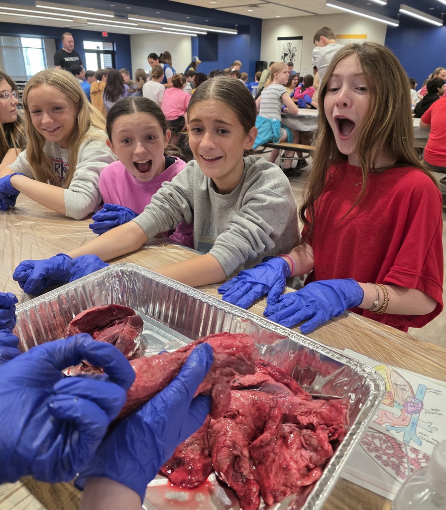 HeartandLungDissection