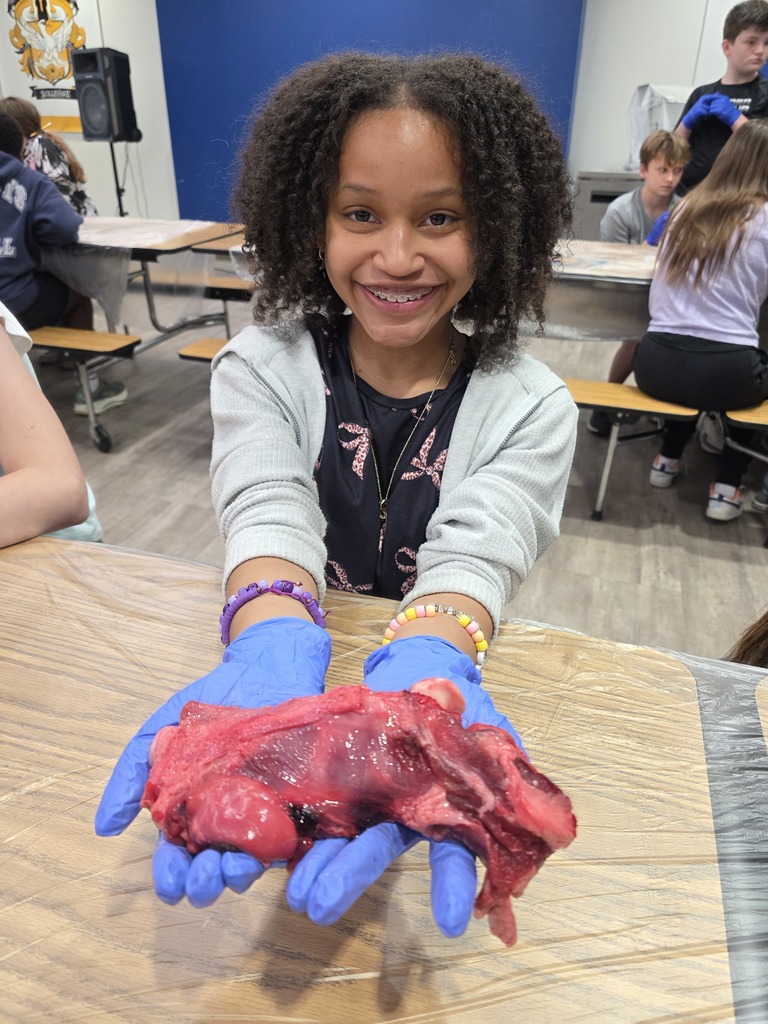 HeartandLungDissection