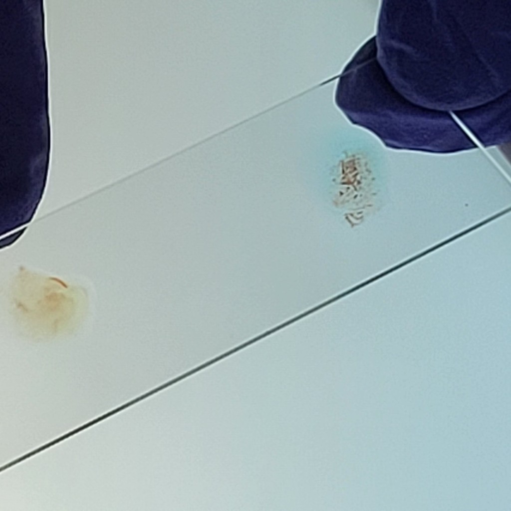 What's your blood type?