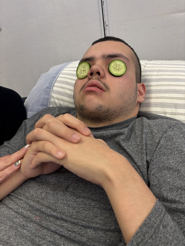 Cucumber slices on eyes
