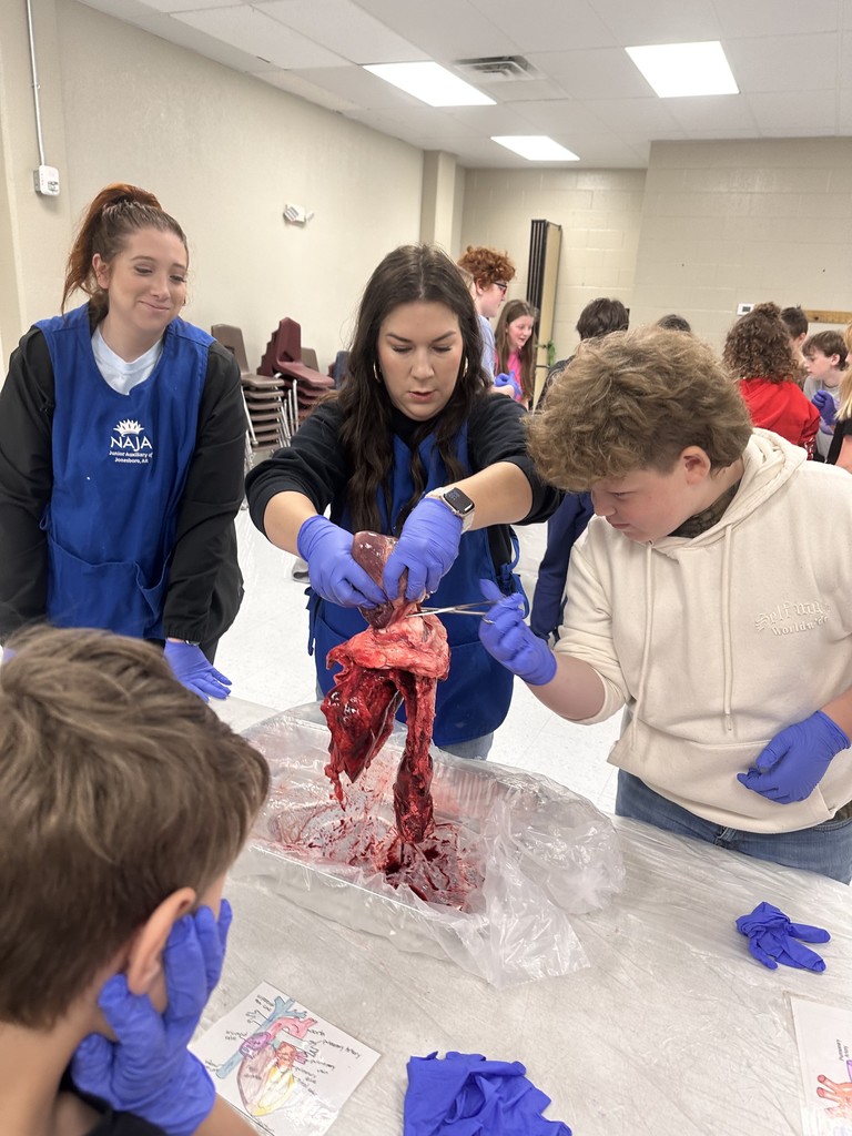 On Friday, our middle school students had an exciting opportunity to dive into real-life science with the ladies of Junior Auxiliary, who visited to lead a pig heart and lung dissection!  This hands-on experience helped students explore the body systems they’ve been studying in class. Seeing how the heart and lungs work together to keep the body functioning was an unforgettable way to connect classroom learning with real-world experiences.   A huge thank you to the Junior Auxiliary for bringing science to life for our students! 