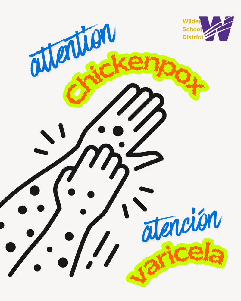chickenpox