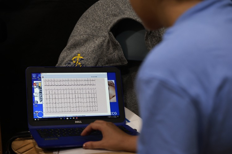 EKG
